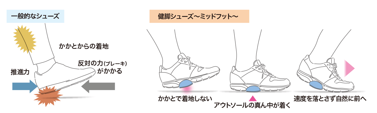 ミッドフット