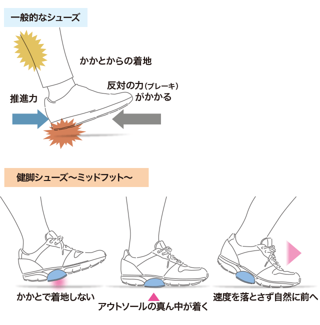 ミッドフット