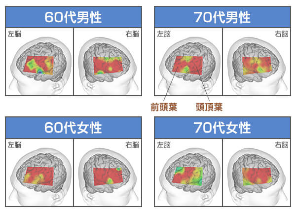 赤くなっているところが、安静時に比べて脳活動が高まっている部分です。 ※脳活動の変化には個人差があります。